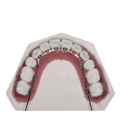 Il cavo diritto ha riparato gli apparecchi ortodontici per il raddrizzamento dei denti