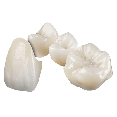 Corona ceramica di biossido di zirconio estetico stabile non che irrita la corona dell'impianto