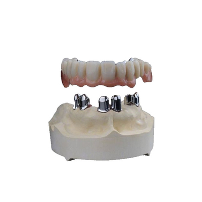 3D dentario ha stampato il biossido di zirconio incorona l'alta biocompatibilità resistente all'uso