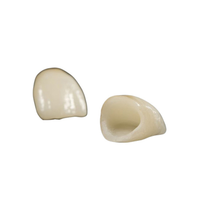 Laboratorio di restauro dentale specializzato in riparazione di zirconia con adattamento preciso