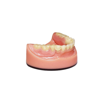 Sistema d'esplorazione intraorale dentario di rappresentazione del ponte 3D Digital dell'OEM PFM