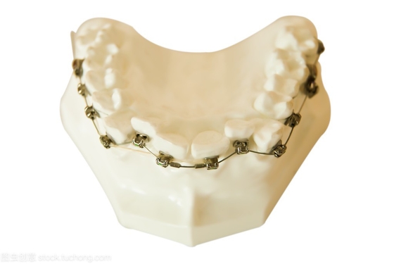 Staffe dentali Ortodonzia Strumenti per la modellazione di denti fissi Apparecchi ortodontici