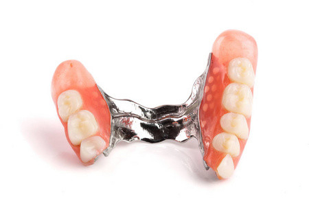 Protesi rimovibili invisibili Denti del giudizio Ripristino di grandi denti Copertura di impianti Temporanea