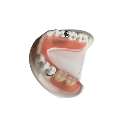 3D ha stampato le protesi dentarie smontabili su ordine di assicurazione di qualità dentaria della corona di biossido di zirconio