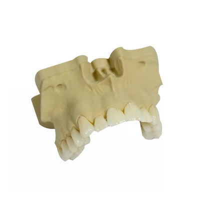 Superficie liscia PFM Dental Crown Aspetto realistico ad alta resistenza