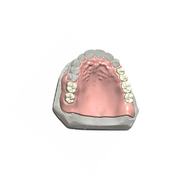 L'assicurazione di qualità dentaria realistica 3D della corona dell'aspetto PFM ha stampato i modelli dentari