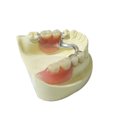 Protesi dentarie parziali smontabili dei materiali del laboratorio dentario sano della protesi dentaria su ordine