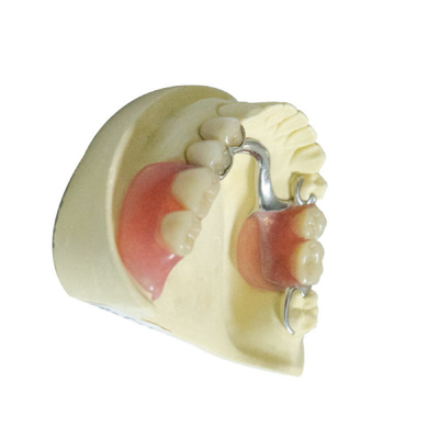 Protesi dentarie parziali smontabili acriliche dei prodotti dentari professionali del laboratorio