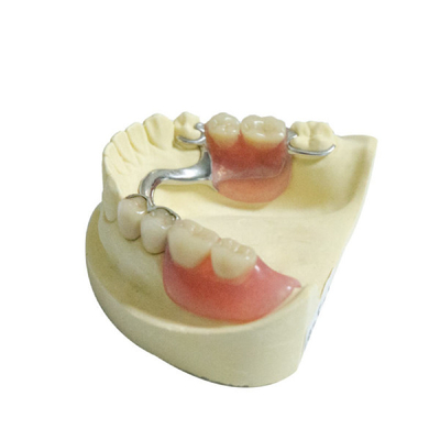 Protesi dentarie parziali smontabili di plastica del laboratorio del CE delle sostituzioni dentarie dei prodotti
