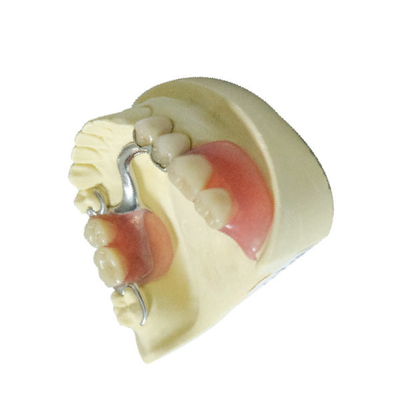 Protesi dentarie parziali smontabili del laboratorio del polimero dentario su ordine dei prodotti