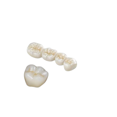 Forte biocompatibilità di resistenza della corrosione di biossido di zirconio della corona dentaria del dente alta