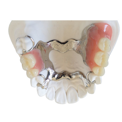 Ponte dentario alto Intermiscibility biologico della corona della stampante PFM dell'OEM 3D