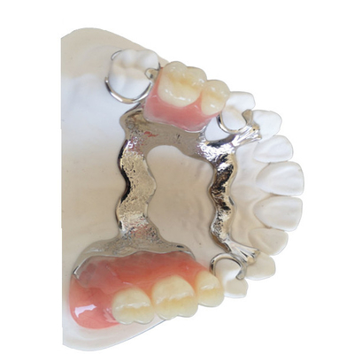 3D che stampa la corona dentaria di PFM ha personalizzato alto Intermiscibility biologico