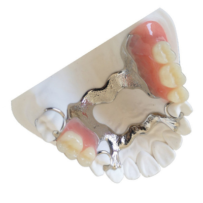 Porcellana dentaria dentaria di FDA della corona del laboratorio PFM fusa alla corona del metallo