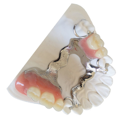 Corona su misura 3D del dente di PFM che stampa il ponte dentario di PFM