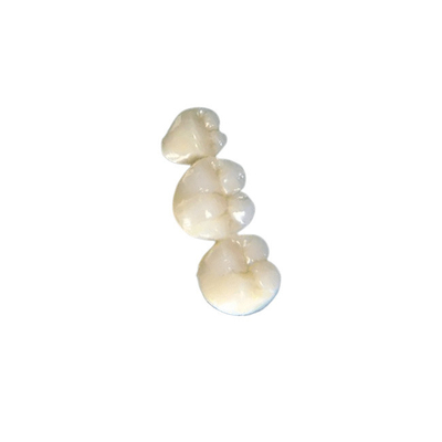 Strutturi duro le corone dentarie ed i ponti che si esercitano masticando la funzione comoda
