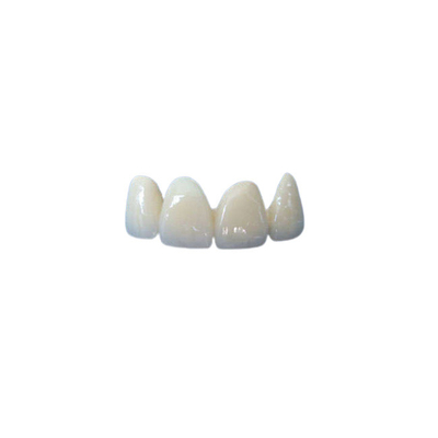 La corona dentaria ceramica della buona stabilità misura correttamente l'alta qualità di igiene orale