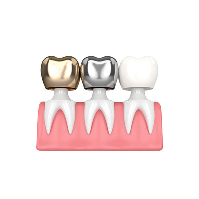 Stalla non facile da indossare dentaria di colore delle corone e dei ponti di buona biocompatibilità