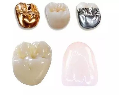 Stalla non facile da indossare dentaria di colore delle corone e dei ponti di buona biocompatibilità