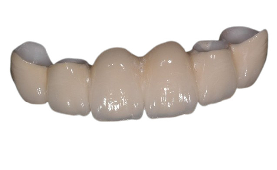 Corona dentaria della porcellana di superficie liscia ristabilire masticazione di buona stabilità di potere