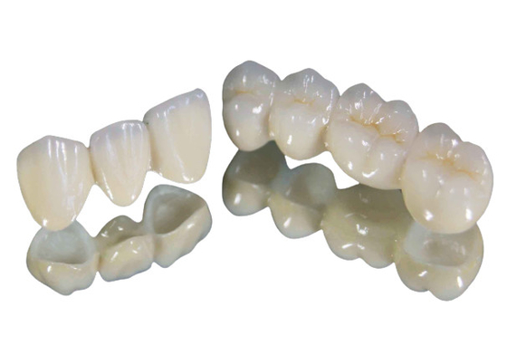 Alta qualità stabile di forte della corona del dente della porcellana colore di resistenza all'usura