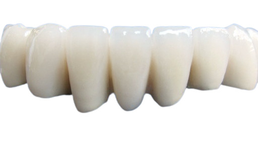 Resistenza non facile da indossare dentaria dell'acido e dell'alcali della corona della bella porcellana