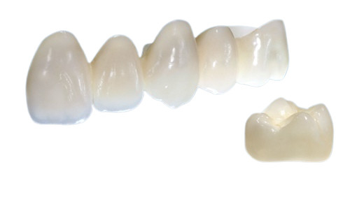 Le corone su misura della porcellana hanno un aspetto reale e un colore naturale