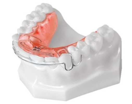 Gli apparecchi ortodontici dentari semplici installano il materiale biologico di alta tecnologia