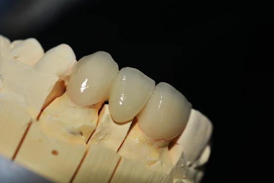 Laboratorio dentistico di protesi circoniali personalizzate - consegna e riparazione veloci