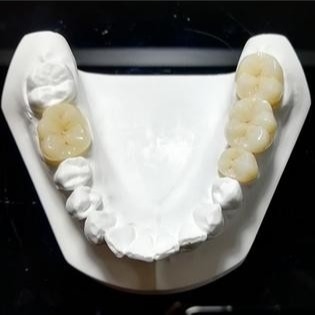 Qualità costante le corone di Mark Of Our Ceramic Dental