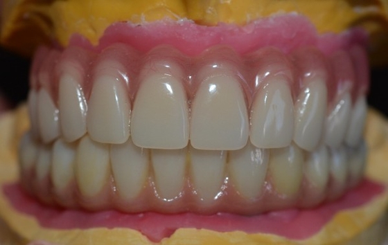 Elevando le norme la nostra assicurazione di qualità della corona dell'impianto dentario