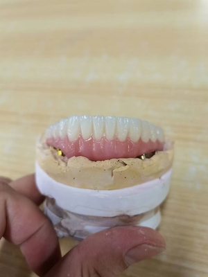 Elevando le norme la nostra assicurazione di qualità della corona dell'impianto dentario