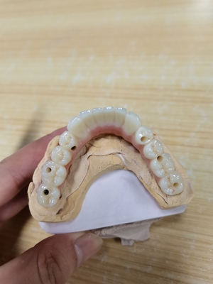 Elevando le norme la nostra assicurazione di qualità della corona dell'impianto dentario