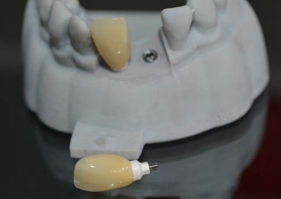 CAD PEEK pilastro personalizzato