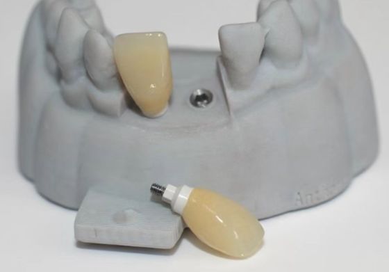 CAD PEEK pilastro personalizzato