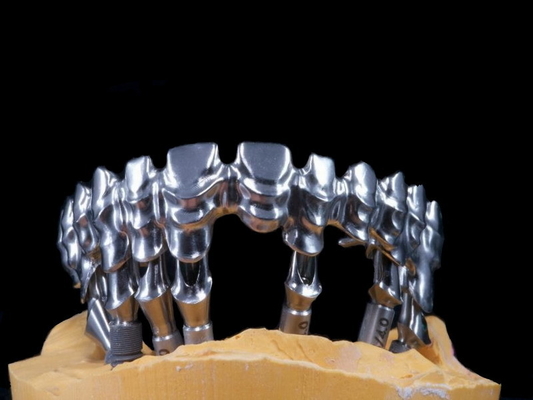 FDA 3014652903 forti altamente estetici dentari del ponte di PFM estremamente
