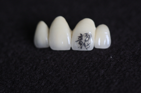Immagine della corona dentale PFM Personalizzazione con modelli personalizzati personalizzati