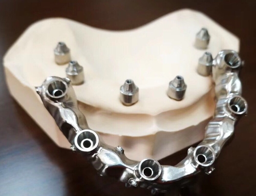 FDA 3014652903 forti altamente estetici dentari del ponte di PFM estremamente