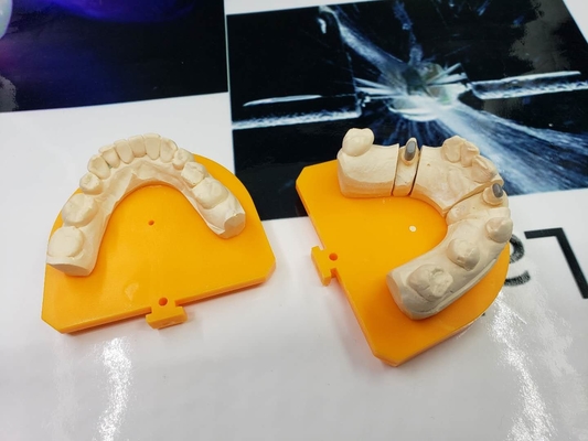 Materiale biologico alta tecnologia del metallo PFM del ponte dentario pieno della corona