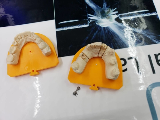 Materiale biologico alta tecnologia del metallo PFM del ponte dentario pieno della corona