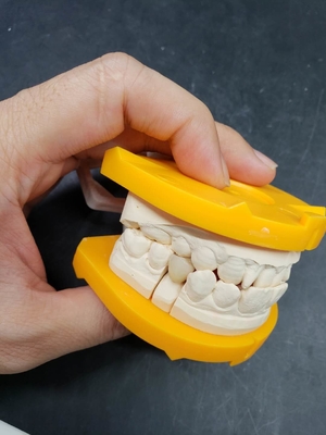 Innovazione al centro delle nostre corone dentarie ceramiche