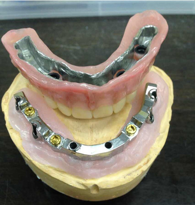 Impianto dentario di sicurezza del laboratorio dell'alta inter protesi dentaria biologica di miscibilità