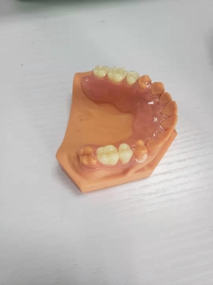3D ha stampato le protesi dentarie per i laboratori dentari basati sui dati di Digital