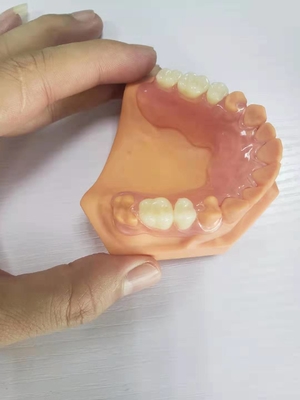 3D ha stampato le protesi dentarie per i laboratori dentari basati sui dati di Digital