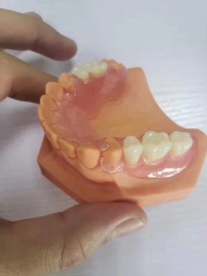 3D ha stampato le protesi dentarie per i laboratori dentari basati sui dati di Digital
