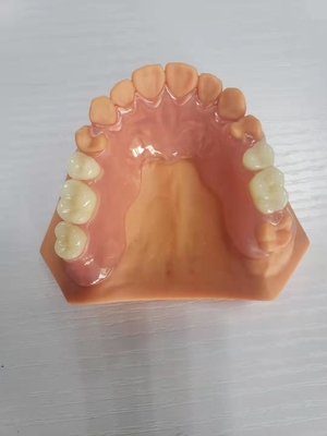 3D ha stampato le protesi dentarie per i laboratori dentari basati sui dati di Digital