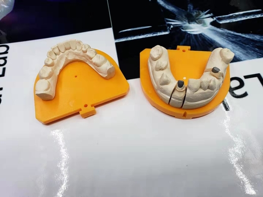 Corona ceramica dentaria della corona PFM della porcellana ad alta resistenza dell'oro giallo