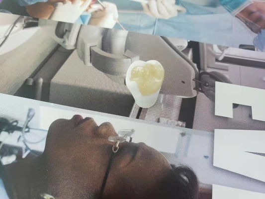 Parte sovrapposto in rilievo dentario Tutto ceramico durevole dell'intarsio dell'impiallacciatura della corona di FDA simile