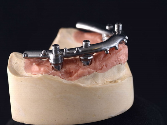 L'impianto di titanio di CNC All-On-4 ha fissato le protesi dentarie per la clinica dentaria