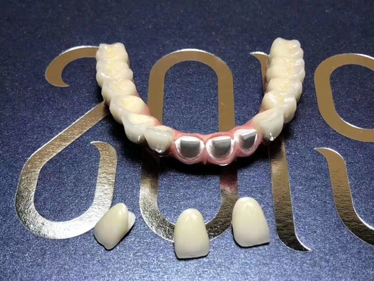 Corona dentaria smontabile del singolo titanio flessibile per la clinica dentaria